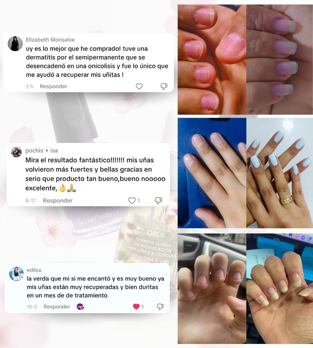 KIT INTENSIVO DE RECUPERACION & CRECIMIENTO DE UÑAS ®